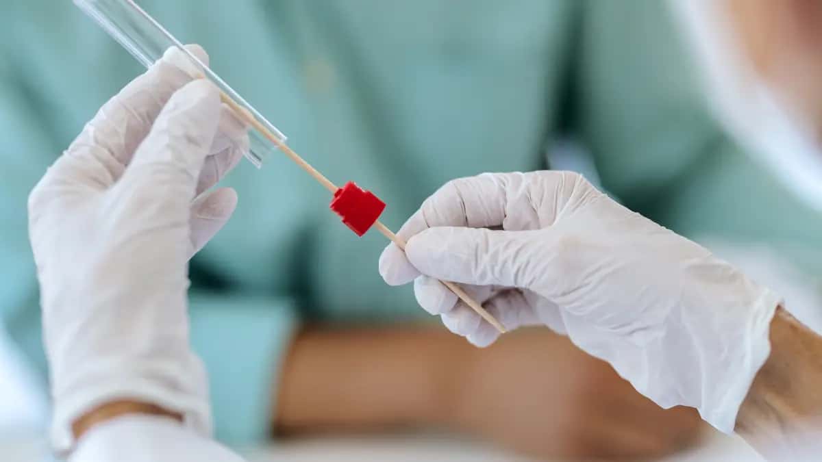 Türkiye’de Ücretsiz Kanser Taraması: Erken Teşhisle Hayat Kurtarmak Mümkün